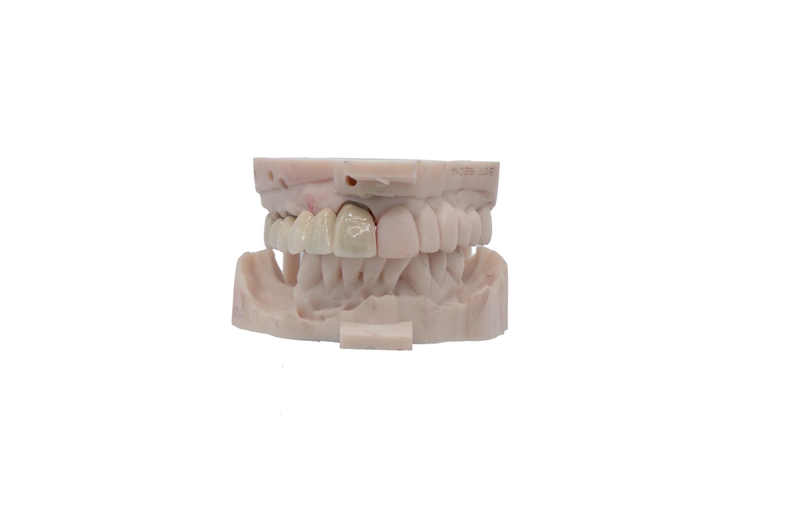 PFM Crown
